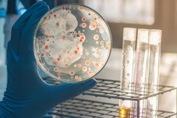 Open consultatie nieuw ZonMw-programma Antimicrobiële resistentie